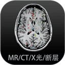 影像解剖图谱app