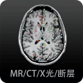 影像解剖图谱软件